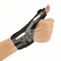 thumb spica splint